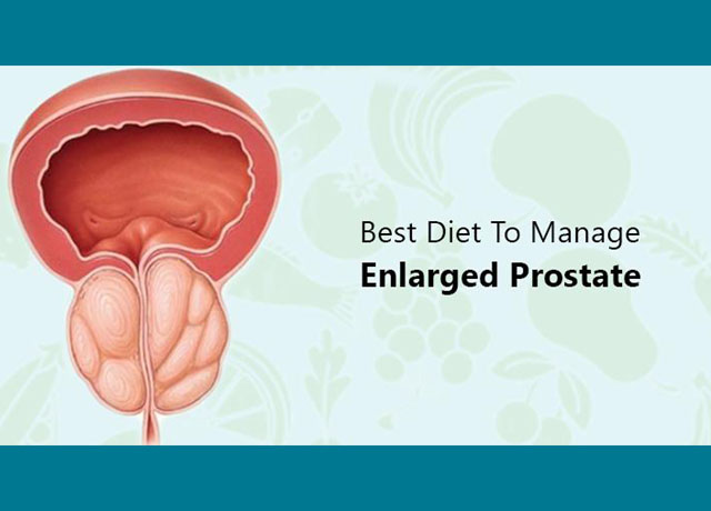 Diet For Enlarged Prostate- Prostate doctor in kolkata