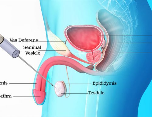 Testicular Biopsy