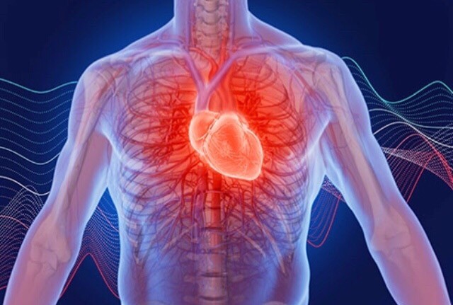 Cardiac Causes of Palpitation