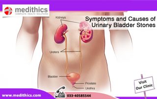 Symptoms and Causes of Urinary Bladder Stones