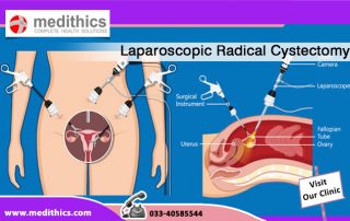 Laparoscopic Radical Cystectomy