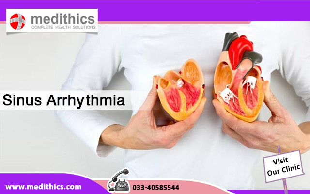 Sinus Arrhythmia