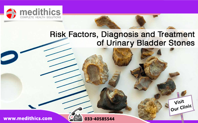 Risk Factors, Diagnosis and Treatment of Urinary Bladder Stones
