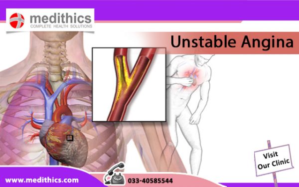 unstable-angina-causes-symptoms-diagnosis-and-treatment