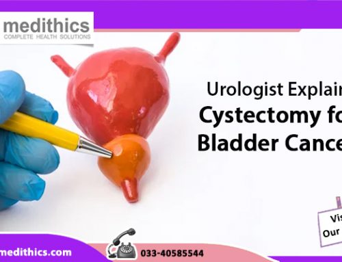 Urologist Explains Cystectomy for Bladder Cancer